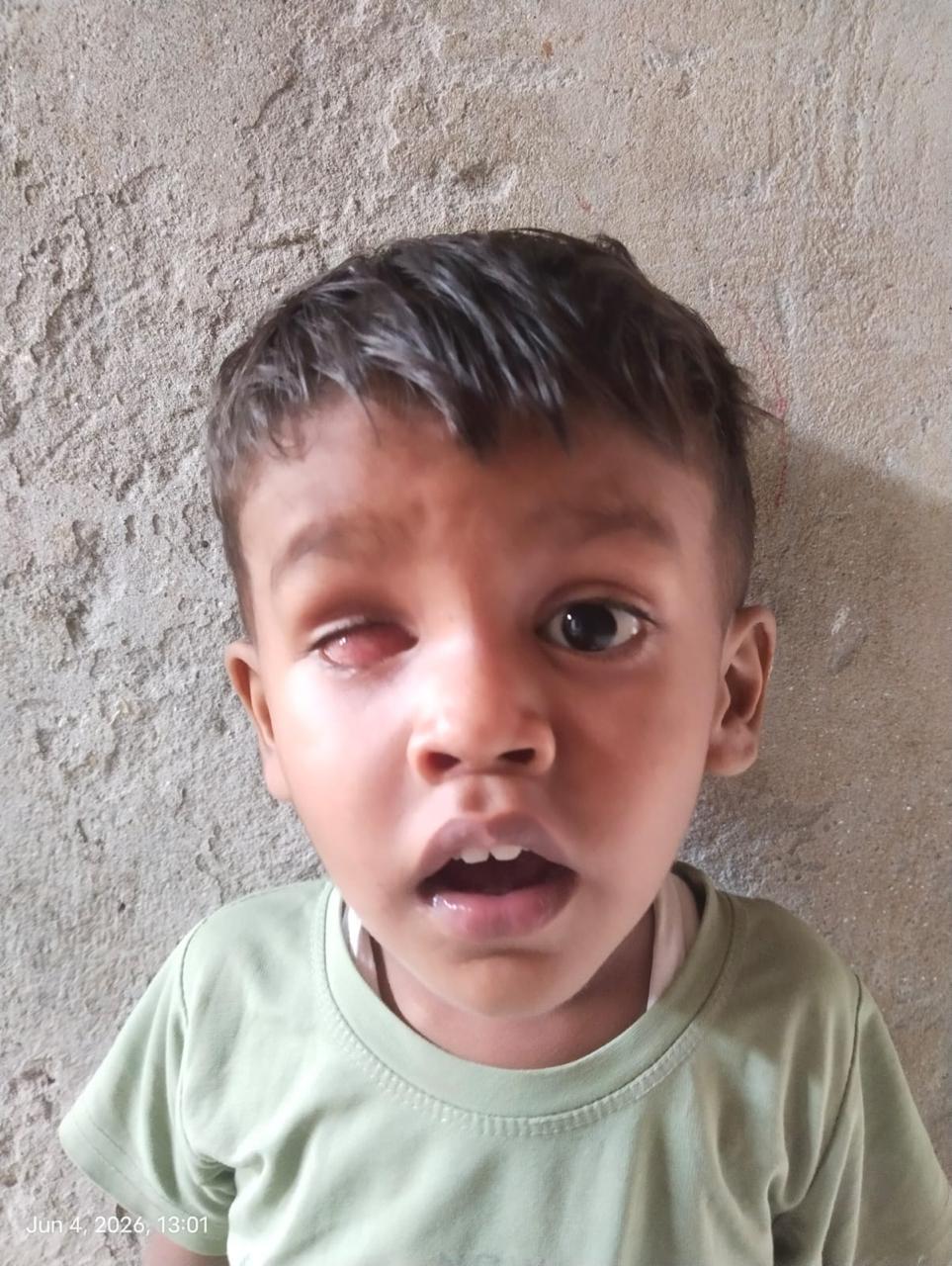Purvansh